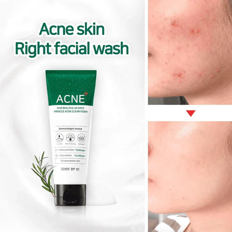 Some by mi Aha BHA PHA 30 Days Miracle Acne Clear Foam 100ml