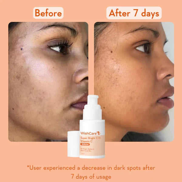 WishCare Super Bright Vitamin C16 Serum 30ml