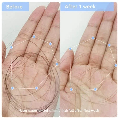 WishCare Hair Growth & Anti Hairfall Duo