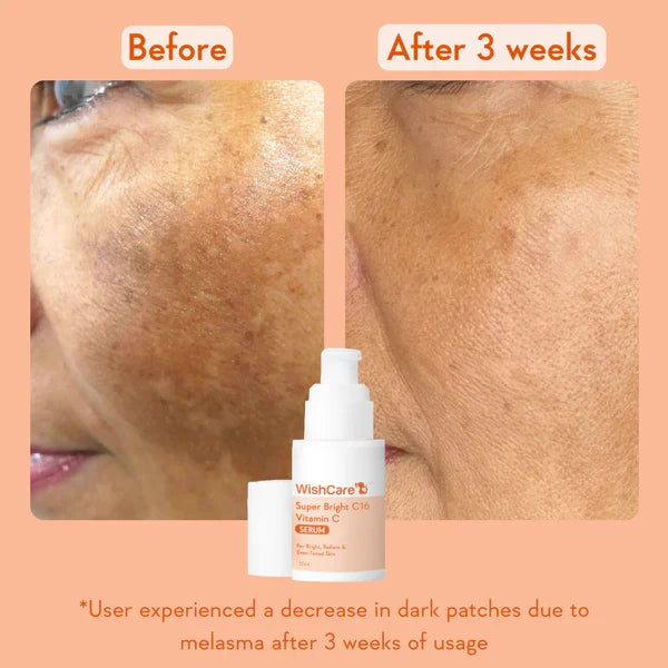 WishCare Super Bright Vitamin C16 Serum 30ml
