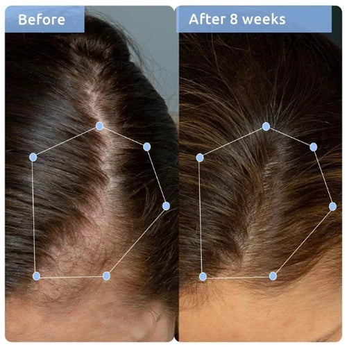 WishCare Hair Growth & Anti Hairfall Duo