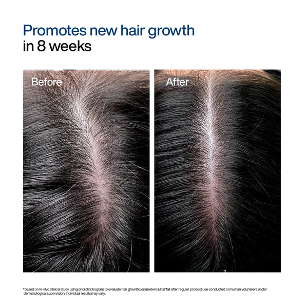 WishCare Hair Growth Serum Concentrate 30ml
