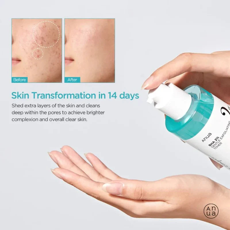 ANUA BHA 2% Gentle Exfoliating Toner – 150ml