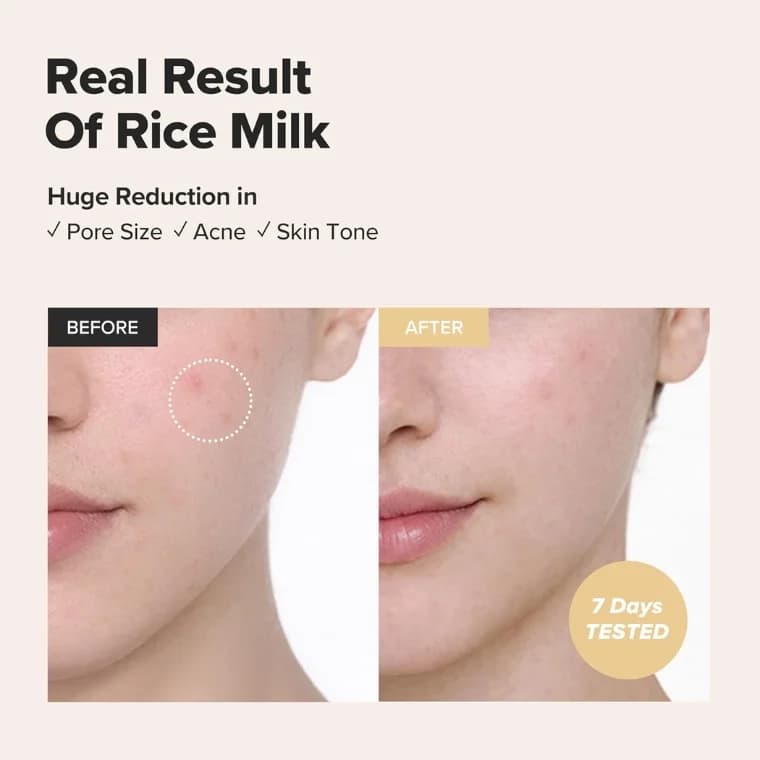 Beauty of Joseon Glow Replenishing Rice Facial Sebum Toner – 150ml