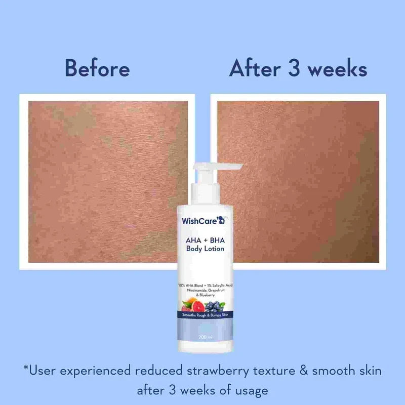 WishCare AHA + BHA Body Lotion 200ml