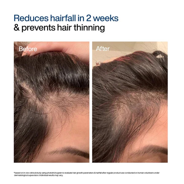 WishCare Hair Growth Serum Concentrate Roll On