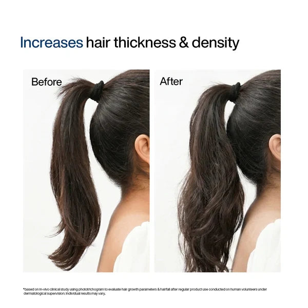 WishCare Hair Growth Serum Concentrate Roll On