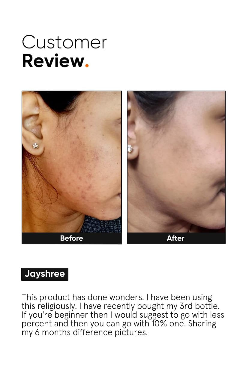 Minimalist Niacinamide 10% Face Serum 30ml