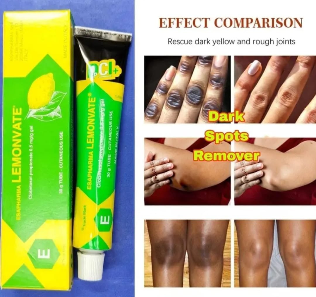ESAPHARMA Lemonvate Cream 30g