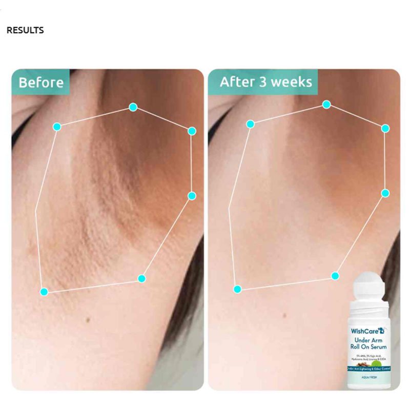 WishCare Under Arm Roll On Serum – 50m