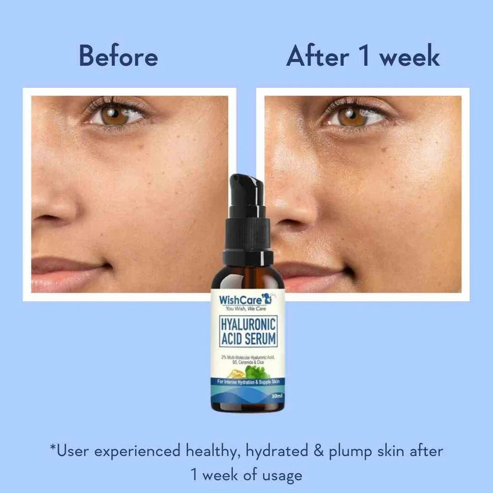 Wishcare Hyaluronic Acid Serum with 2% Multi-Molecular HA, Panthenol, Ceramide & Cica – For Intense Hydration – 30ml