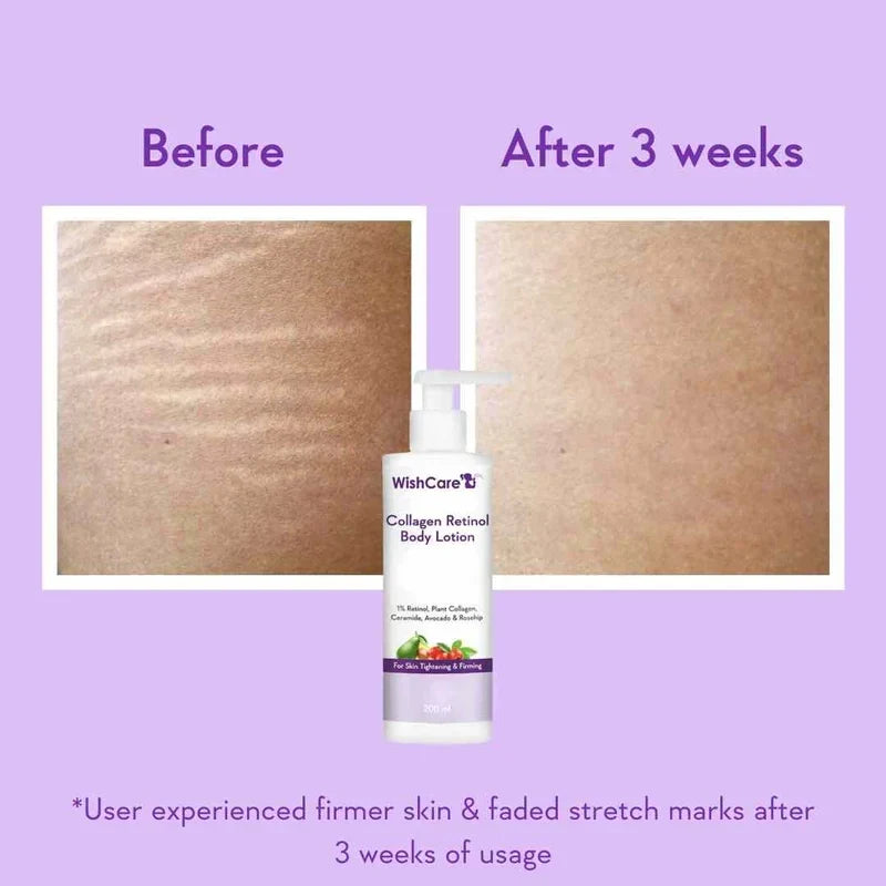 WishCare Collagen Retinol Body Lotion 200ml