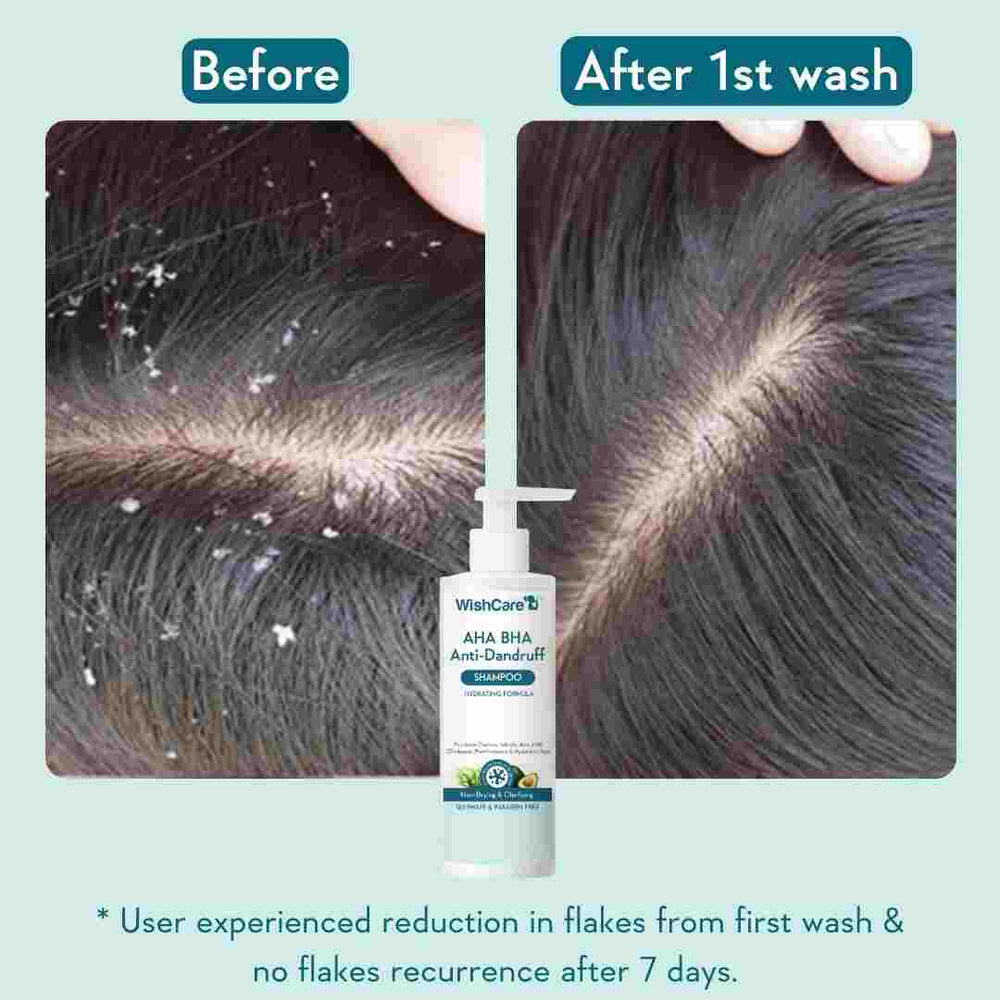 Wishcare AHA BHA Anti-Dandruff Shampoo 250ml
