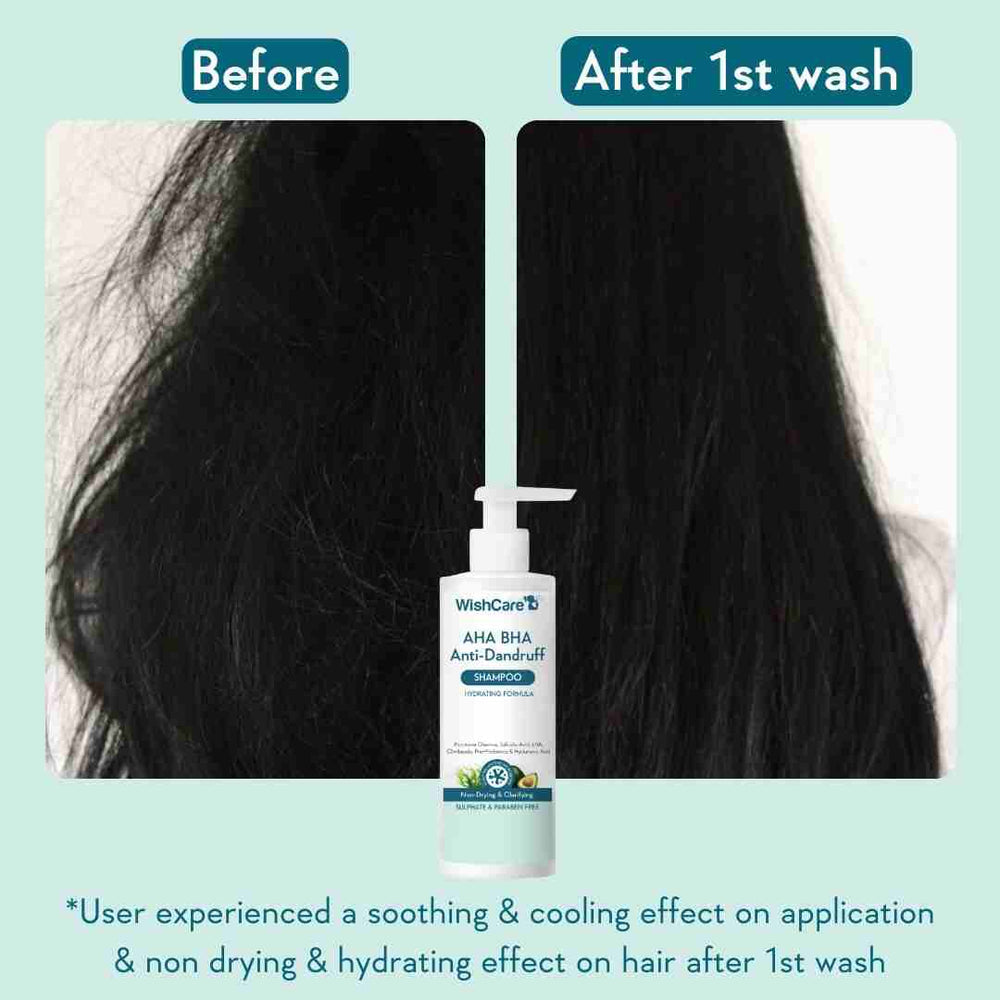 Wishcare AHA BHA Anti-Dandruff Shampoo 250ml