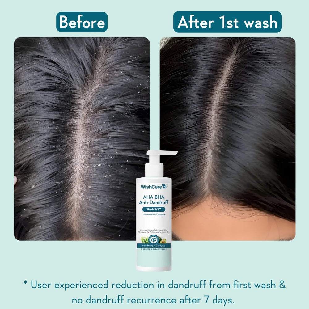 Wishcare AHA BHA Anti-Dandruff Shampoo 250ml