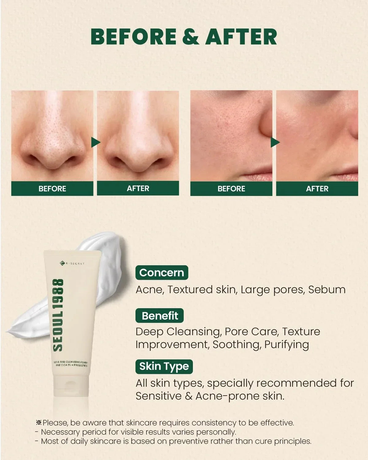 K-SECRET-SEOUL 1988 Cleansing Foam : Pine Cica 1% + Probiotics 150ml