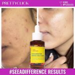 GOOD MOLECULES DISCOLOURATION CORRECTING SERUM 30ml - Image 4