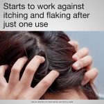 NEUTROGENA – T/Gel Therapeutic Shampoo 125ml - Image 4