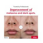 EQQUALBERRY VITAMIN ILLUMINATING SERUM 30ML - Image 4