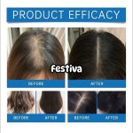 Seapuri Scalpy Hair Serum 20ml - Image 5