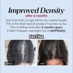 Seapuri Scalpy Hair Serum 20ml - Image 4