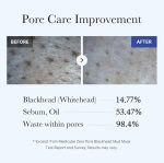 Medicube Zero Pore Blackhead Mud Mask 100g - Image 4