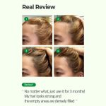 Some By Mi Cica Peptide Anti Hair Loss Derma Scalp Shampoo 285ml