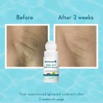 WishCare Aqua Fresh Under Arm Roll On Serum 50ml