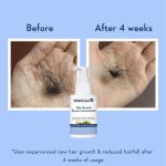 WishCare Hair Growth Serum 30ml